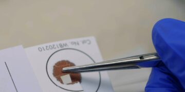 A DNA sample card is handled with tweezers in 7NEWS Spotlight Investigates: DNA Disasters