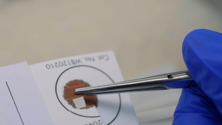 A DNA sample card is handled with tweezers in 7NEWS Spotlight Investigates: DNA Disasters